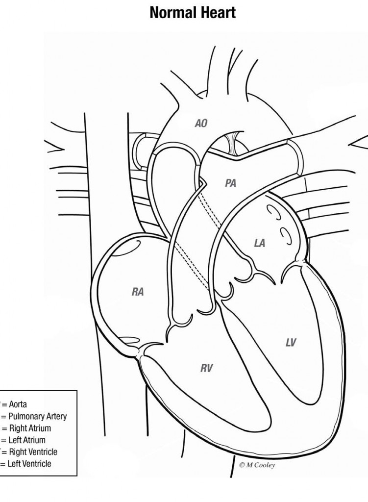 9503_Congenital Heart Defects
