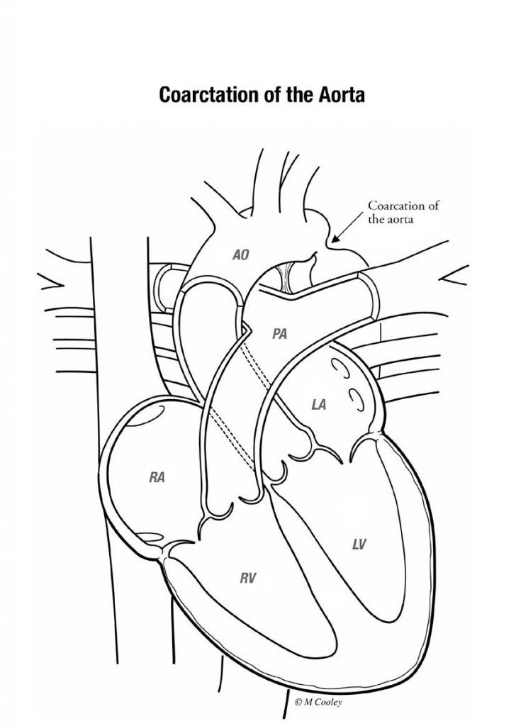 9503_Congenital Heart Defects1