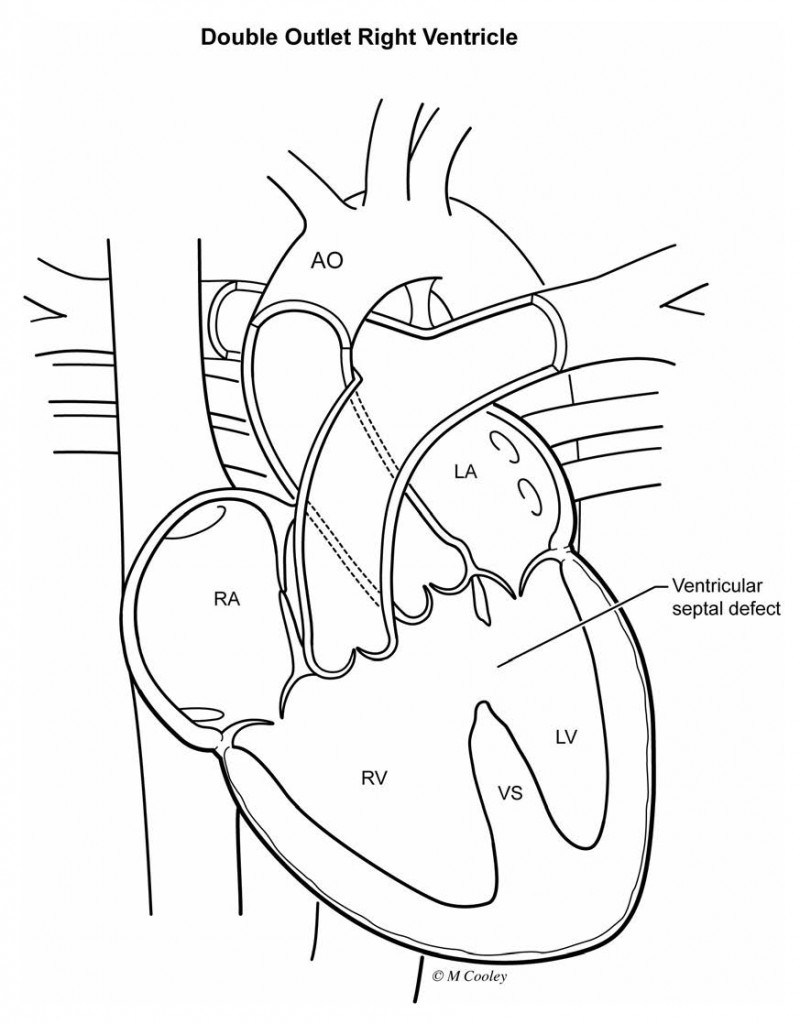 9503_Congenital Heart Defects2